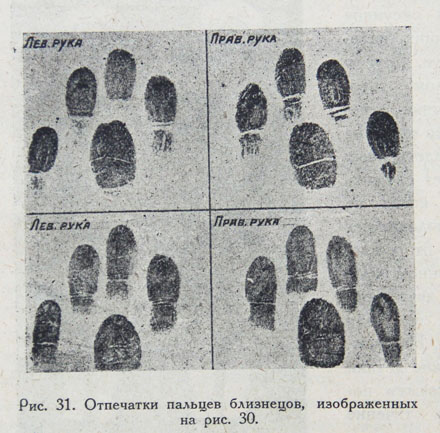 Интересные факты женщинам близнецы. У близнецов одинаковые отпечатки пальцев. Метод близнецов. Отпечатки пальца у близнецов. Отпечатки пальцы одинаковые.